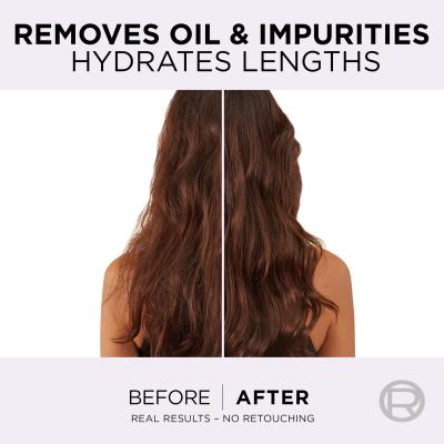 L&#039;Oréal Paris Elseve Hyaluron Pure Oil Erasing Scalp Serum Sérum na vlasy pre ženy 102 ml